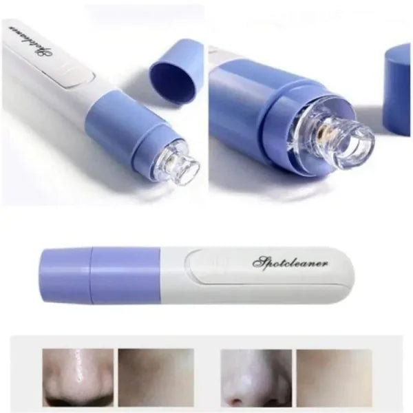 New Electric Blackhead Remover Sucker Black Head Pimple Pore Cleaner Vacuum Blackhead Remover Pore Cleaner (random Color)